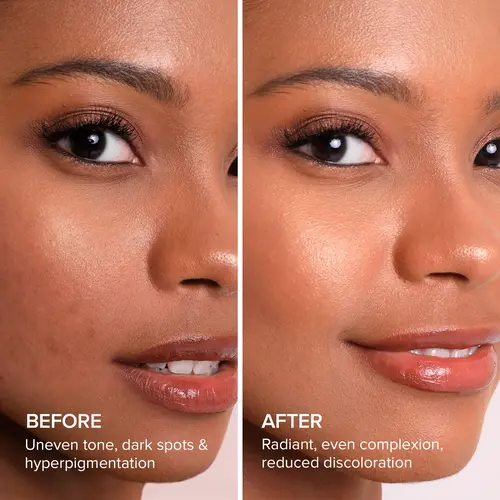 Maree Kojic Acid Soap & Scrub Before & After